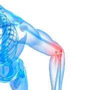  What is Bursitis? How is it Treated?